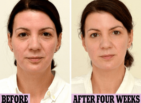 Lady from the article. Google the article if your would like to read about it. 